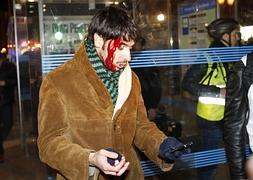 Un periodista resultó herido durante los disturbios. / Foto: Javier Lizón (Efe) | Vídeo: Atlas/