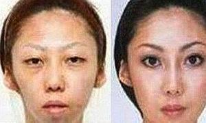 La mujer, antes y después de las cirugías plásticas/