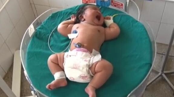 Una Mujer Da A Luz En La India A Un Bebe De 7 Kilos El Correo